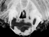 Primary pontine hemorrhage in a patient with acute promyelocytic leukemia